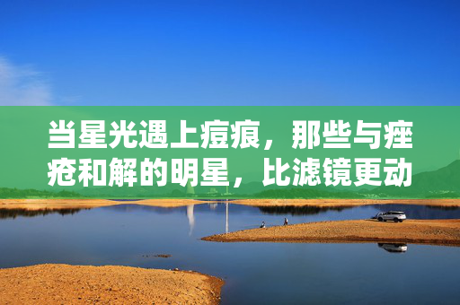 当星光遇上痘痕,那些与痤疮和解的明星,比滤镜更动人
